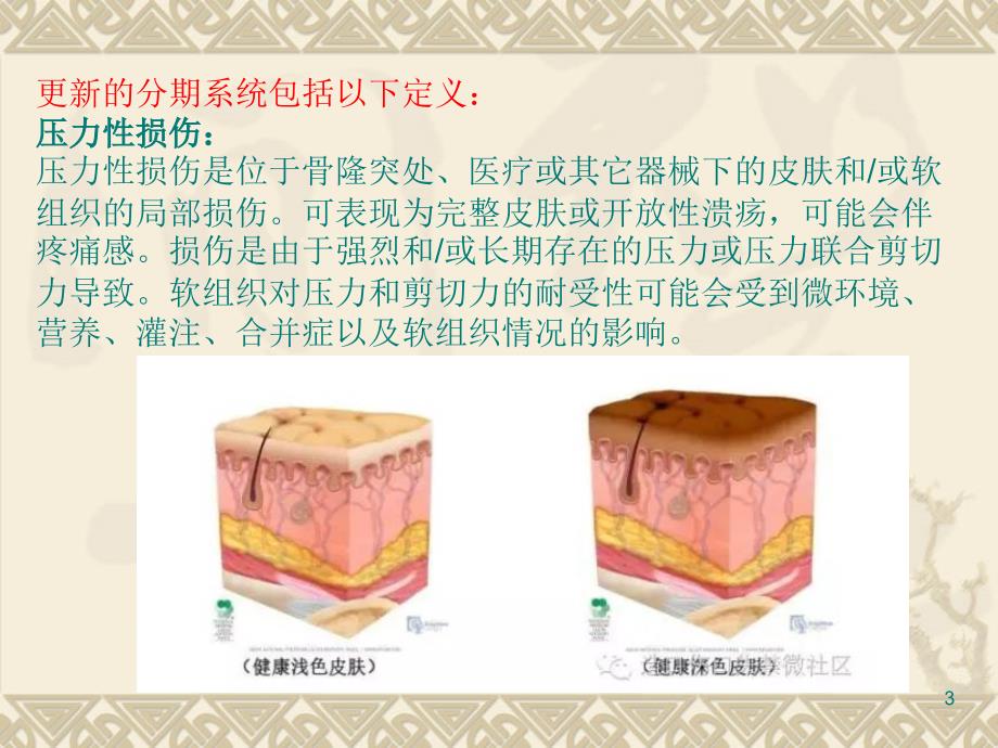 压疮的分期及临床表现最新版